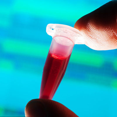 Laboratorium Pengujian yang Disetujui FDA Deteksi Cepat Kontak Makanan Botol Bayi Layanan autentikasi pihak ketiga